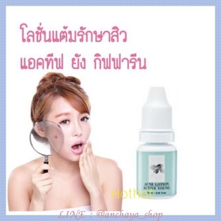 โลชั่น แต้มสิว กิฟฟารีน Active Young Acne Lotion