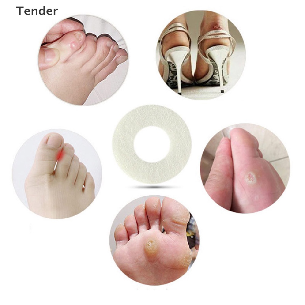 [Preferred] Relieve Pain Feet Treatment Warts Thorn Remove Plantar High