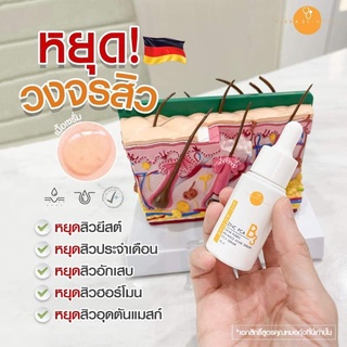 V-Active B3 เซรั่มสิว/ตัวจัดการสิวหมอกุ้ง **ตัวHot**แพคเกจใหม่