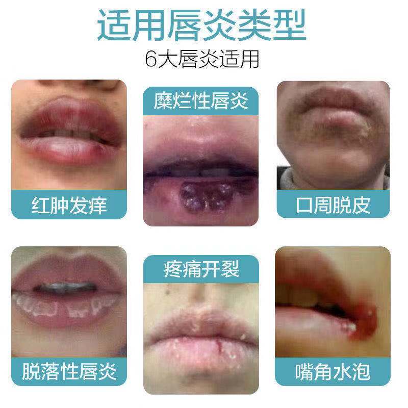 พร้อมส่งลิปบาล์มของใช้ส่วนตัว Yunnan Materia Medica Lip Balm Lip Balm