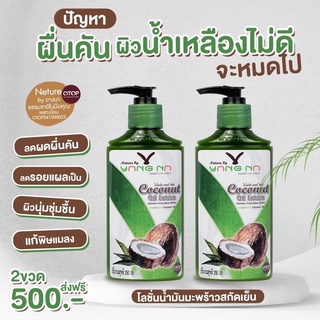 [2ขวดส่งฟรี] โลชั่นน้ำมันมะพร้าว ขาลาย ท้องลาย น้ำเหลืองไม่ดี รอยแผลเป็น สิวที่หลัง สะเก็ดเงิน ขายดี1