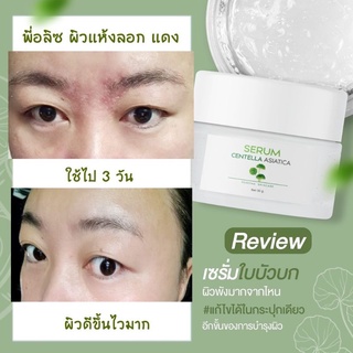 [พร้อมส่ง] เซรั่มใบบัวบกพรทิน่า✅ของแท้ กู้หน้าพัง ผิวแพ้ง่าย เด็ก✅คนท้องใช้ได้ ขนาด30กรัม