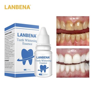 🌟Free shipping🌟LANBENA เซรั่มฟอกฟันขาว กำจัดคราบฟันทุกชนิด ฟันสะอาด ที่ฟอกฟันขาว เซรั่มฟอกฟัน ฟอกสีฟัน 25ml