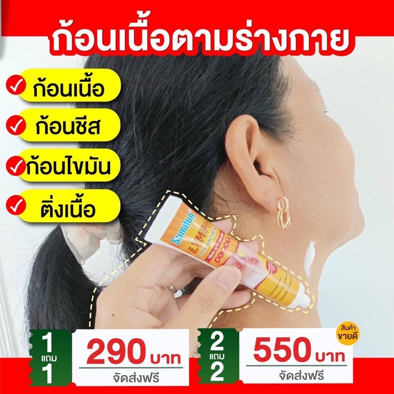 ซื้อ 1 แถม 1 ฟรี ครีมทาซีส ก้อนเนื้อ ก้อนไขมัน