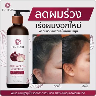 แค่สระเท่านั้น❗เร่งผมยาว ลดผมร่วง FINHAIR (ฟินแฮ) แชมพูหอมแดง+ขิง  สุดยอดอาหารกระตุ้นรากผมที่สาวๆตามหา