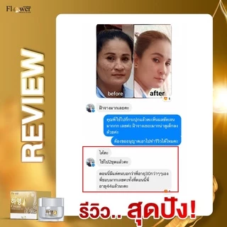 [เก็บโค้ดส่งฟรี+พร้อมส่ง]Hayeong ฮายอง ของแท้จากโรงงาน⭐ 하영สกัดจากโสมเกาหลี หน้าใส แก้ฝ้า หน้าคล้ำ 🇰🇷 ริ้วรอย จุดด่างดำ