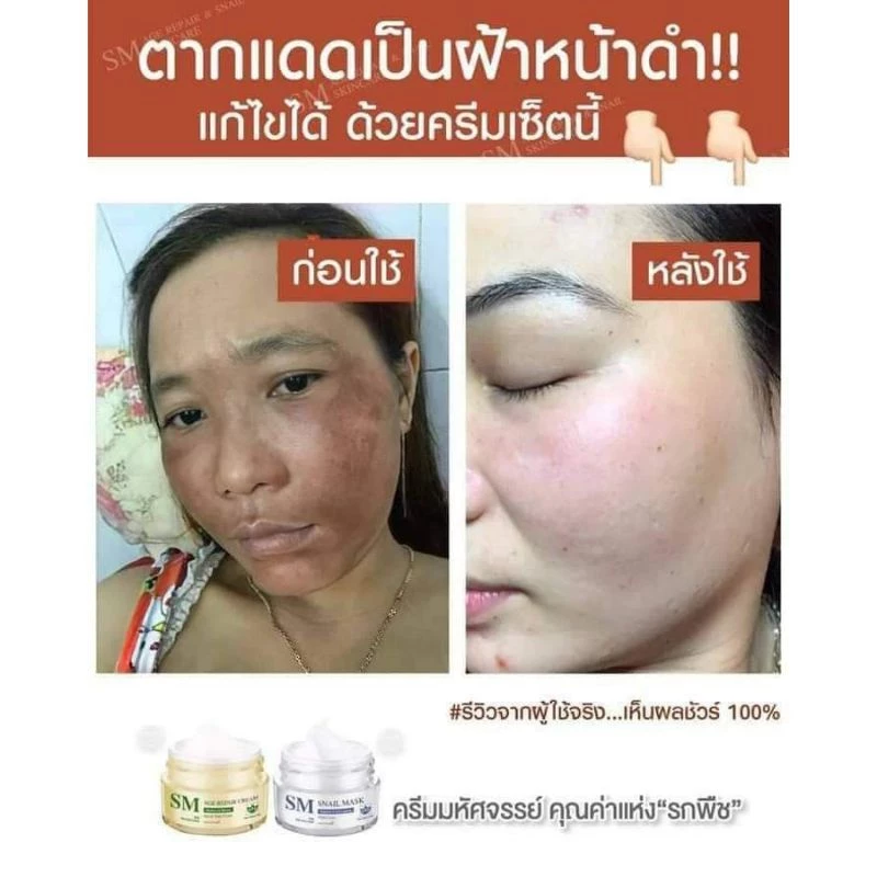 ✅ [ส่งฟรี+ส่วนลด] เซตครีมรกพืชเอสเอ็ม SM 15 g. #SM Skincare#เอสเอ็ม สกินแคร์ thumbnail 7