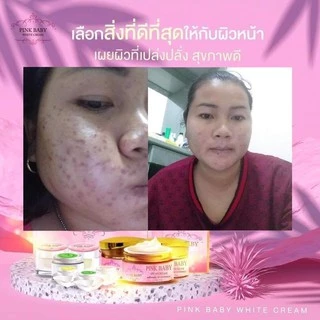 [ลดทันที 50฿ โค้ดDETSEP199] Pink Baby Cream ครีมพิ้งค์เบบี้ แบบชุด แบบแยก