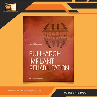 Full-Arch Implant Rehabilitation
