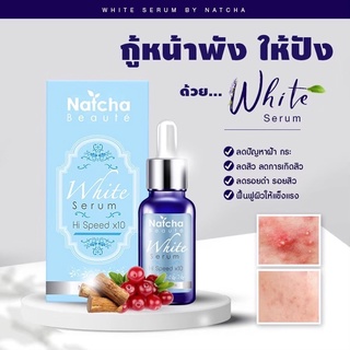 เซรั่มณัชชา Natcha Serum ของแท้100% ร้านนี้ส่งฟรี มีของแถม