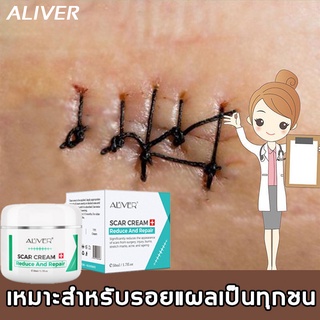 【มีสินค้า】ALIVER 50ml ครีมลดรอยแผลเป็น  ลบรอยครีมแผลเป็น ครีมรักษาแผลเป็น ยาทาแผลเป็น ลดรอยแผลเป็น