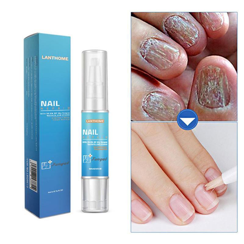 *ส่งจากไทย*fungal Nail Repair Treatment pen toe nails Fungus Remover Protective Nail Pen Brush Nail รหัส 6037