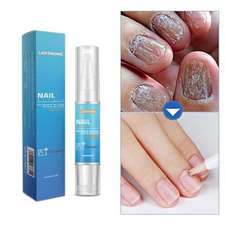 *ส่งจากไทย*fungal Nail Repair Treatment pen toe nails Fungus Remover Protective Nail Pen Brush Nail  รหัส 6037