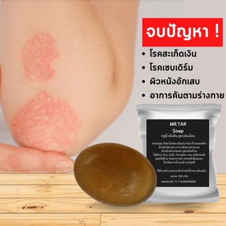 MR.TAR Soap สบู่น้ำมันดิน ขนาด100 กรัม รักษาโรคสะเก็ดเงิน เซบเดิร์ม ผิวหนังอักเสบ ผื่นคัน  มีเก็บเงินปลายทาง