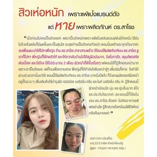 ดร.สาโรช เฮอร์เบิล แอคเน่เคลียร์ โลชั่น (โลชั่นสิว) สำหรับสิวอุดตัน สิวอักเสบ ส่งฟรี