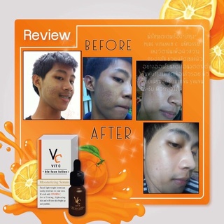 🍊VC Vit C Bio face Serum (10 ml.) เซรั่มวิตซีน้องฉัตร