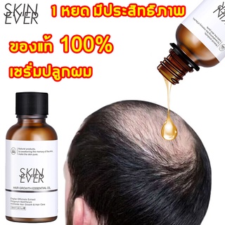 SKIN EVER เซรั่มปลูกผม 30ml น้ำยาปลูกผม ฟื้นฟูผม ป้องกันผมร่วง เซรั่มบำรุงผม เร่งผมขึ้นใหม่ รักษาผม ลดผมร่วง หยุดผมร่วง