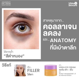 ดูแลผิวรอบดวงตา วิกกา อายครีม EYE CREAM