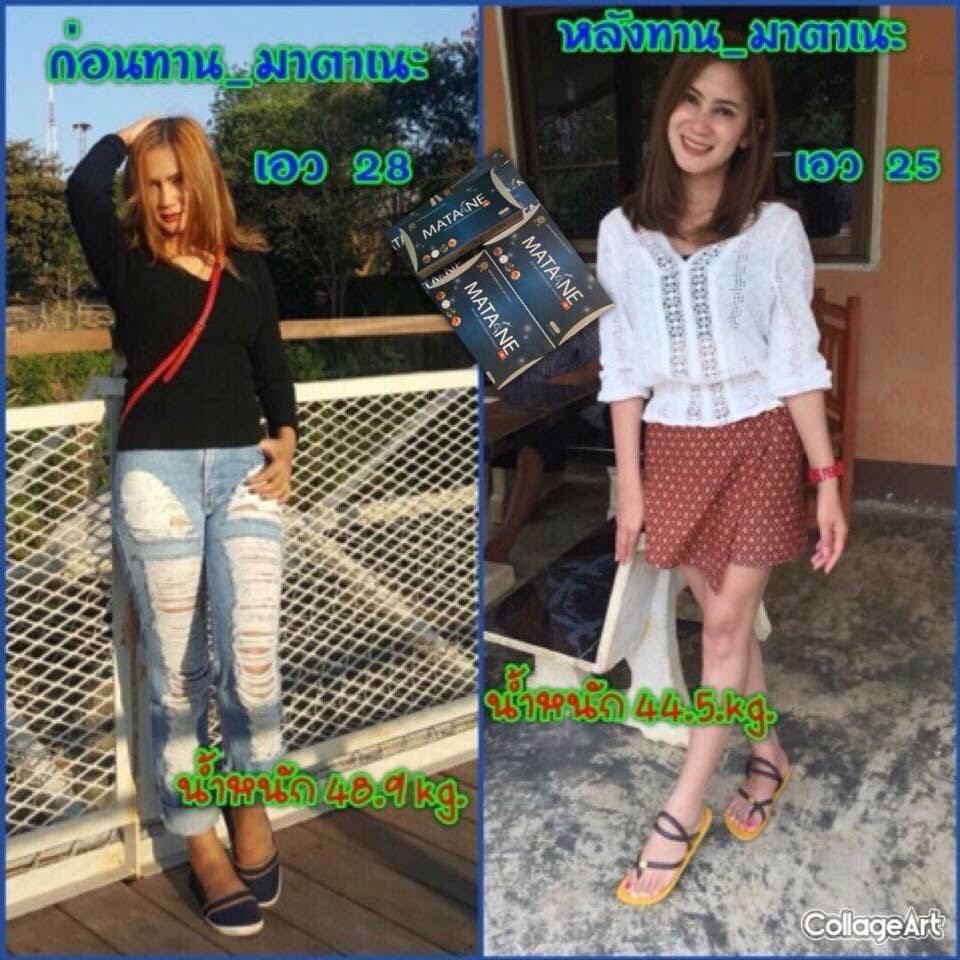 5 แถม 1 Matane มาตาเนะ ผลิตภัณฑ์อาหารเสริมควบคุ้มน้ำหนัก รูปที่ 8