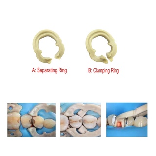 Resin Ring 4 PCS/box