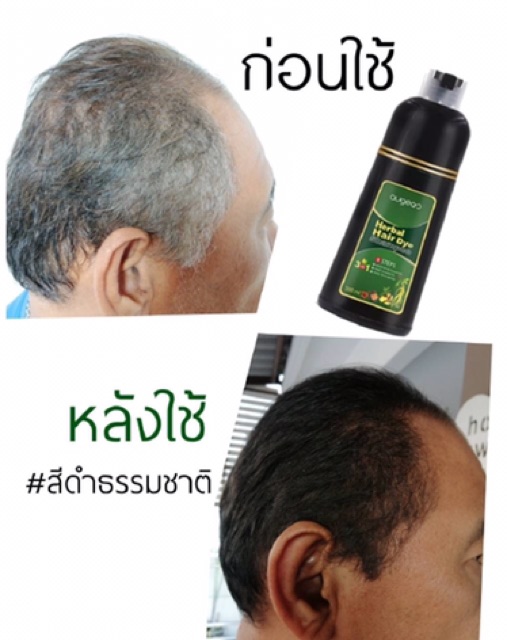 Augeas แชมพูปิดหงอกใน 10 นาที