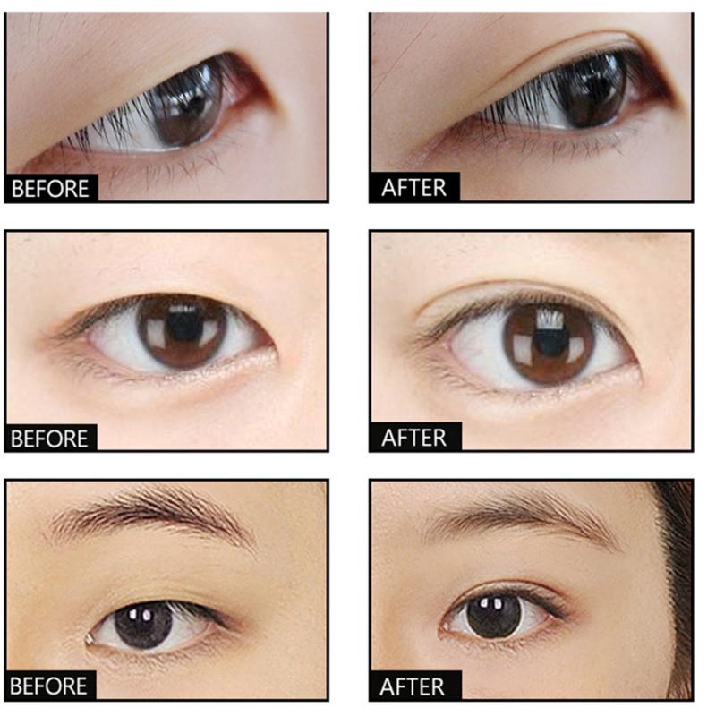 double eyelid stretch