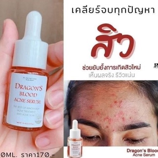 3 ชิ้น   ส่งฟรี ไม่ต้องใส่โค้ด เซรั่มเลือดมังกร Dragons Blood Acne Serum 🐱‍🐉 By PL Skincare ของแท้มีรหัสตัวแทน