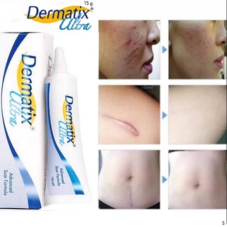 DERMATIX ULTRA GEL เจลป้องกันรอยแผลเป็น ลดรอยดำรอยแดงจากสิว