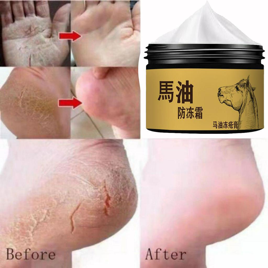 Horse Oils Foot Cream Anti-Chapping Skin Repairing Moisturizer Feet Heel