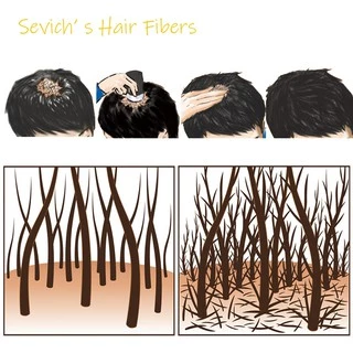 SEVICH ไฟเบอร์เพิ่มผมหนา 5*100 กรัม