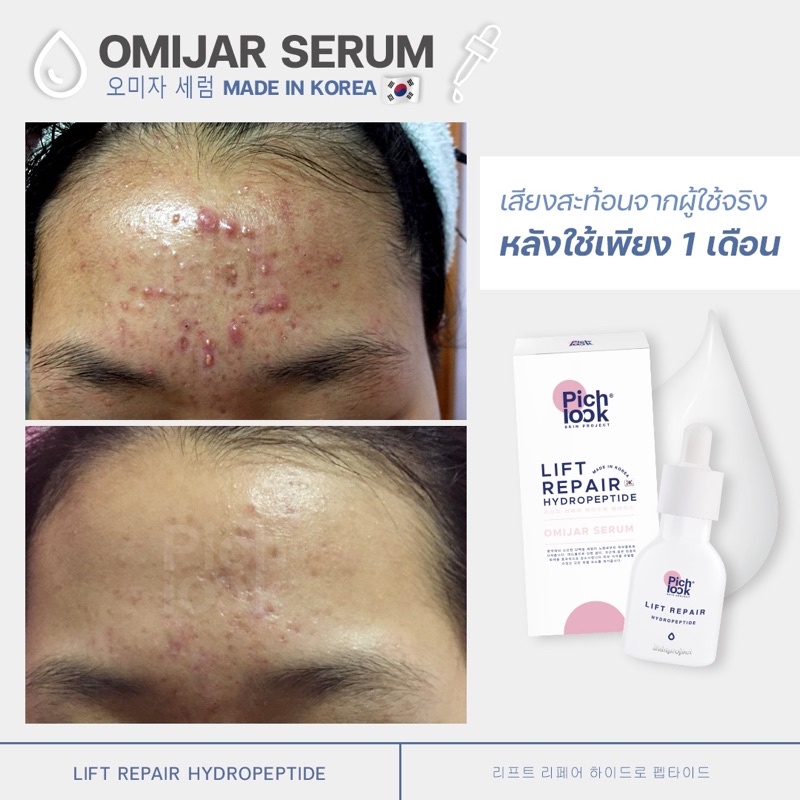 omija serum โอมิจาเซรั่ม 🇰🇷🇰🇷