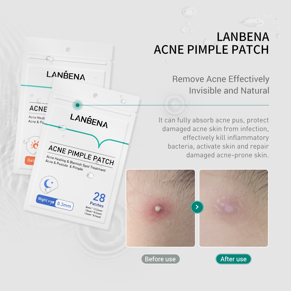LANBENA แผ่นแปะสิว รักษาสิว 25 ชิ้น สูตรกลางคืน 28 ชิ้น ดูแลผิวหน้าสิว ...