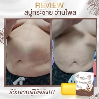 สบู่กระชายว่านไพล กำจัดติ่งเนื้อ ฝ้ากระ คอดำ ใบหน้าคล้ำ แก้ปัญหา กลาก เกลื้อน เชื้อรา สะเก็ดเงิน สิวที่หน้า สิวที่หลัง