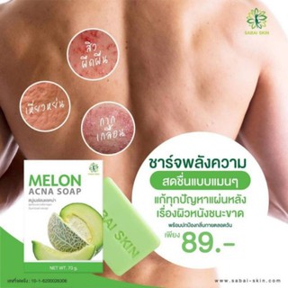 MELON ACNA SOAP สบู่เมล่อน เอคเน่ เชื้อรา ผดผื่นคัน แบคทีเรีย