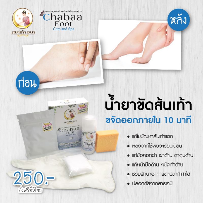 ขายส่ง ราคา 5ชิ้นขึ้นไป