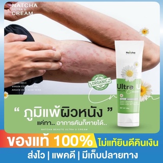 **น้ำกัดเท้า ครีมทาเชื้อรา** จ่าย 2 ได้ 3 ครีมอัลตร้ายู Ultra U อัลตร้ายู  ครีมณัชชา ภูมิแพ้ผิวหนัง โรคผิวหนัง ผื่นคัน