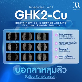 GHK2-Cu (Tripeptide:Cu=2:1) ฟื้นฟูหลุมสิว ซ่อมแซมผิว กระตุ้นการสร้างคอลลาเจนใหม่ -ขนาด 25g