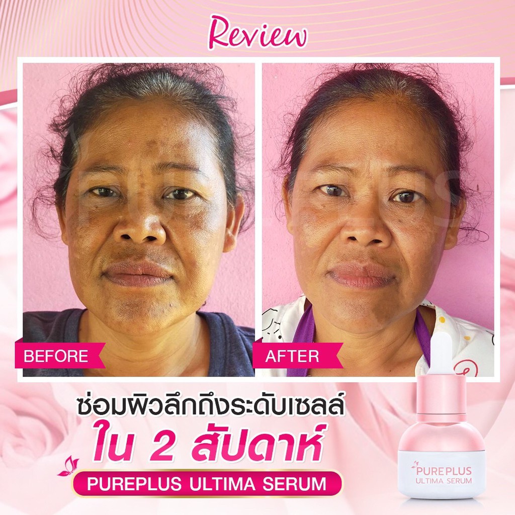 à¸‹à¸·à¹‰à¸­ 1à¹ à¸–à¸¡2???? à¸ªà¹ˆà¸‡à¸Ÿà¸£à¸µâ€¼ï¸ Pureplus à¸­à¸±à¸¥à¸•à¸´à¸¡à¸²à¹€à¸‹à¸£à¸±