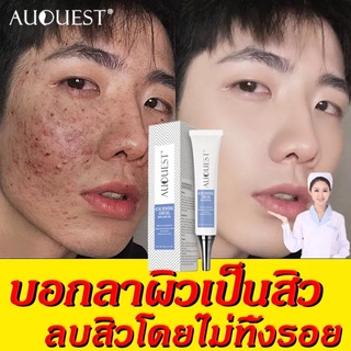 ครีมลดสิว กำจัดสีว สิวอุดตันซ่อมแซมรอยสิวAuQuest Acne cream-1519