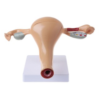 CHA Human Pathological Uterus Ovary Model Anatomical Anatomy For Teaching PXG7