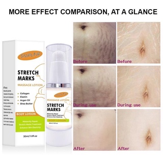 ครีมสเตรทมาร์ค:โลชั่น30ml