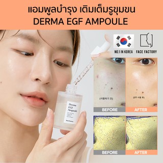 [Seoul2u🌟Only] Face Factory - Derma EGF Ampoule แอมพูลรักษาสิว รักษารอยดำ ลดสิว กำจัดสิว รอยแดง ของแท้/พร้อมส่ง🇰🇷