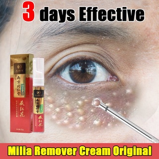 Milia remover cream original 20ml น้ํายาล้างถุงใต้ตา ของแท้ , วงกลม ในดวงตา , ครีมกําจัดถุงใต้ตา , เซรั่ม, เพียวรีย์, น้ํายาล้างเม็ดไขมัน