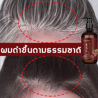 แชมพูปิดผมหงอก300ml（สีย้อมผม แชมพูเปลี่ยนสีผมดำ แชมพูสระผมสีดำ ครีมย้อมผมหงอก ครีมย้อมสีผม ย้อมผมสีดำ แชมพูสมุนไพร ）