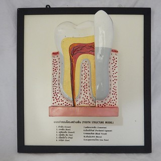 แบบจำลองโครงสร้างฟัน (Tooth Structure Model)