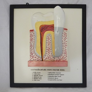 แบบจำลองโครงสร้างฟัน (Tooth Structure Model)