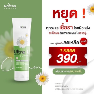 🔺พร้อมส่ง✅ส่งฟรี มีโปรแถม🔺Ultra U อัลตร้ายู ครีมทาสะเก็ดเงิน กลาก เกลื้อน น้ำกัดเท้า เชื้อราผิวหนัง ครีมทาแก้คัน เชื้อรา