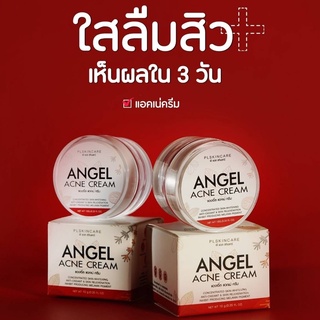 3 ชิ้น 💓 ส่งฟรี 💓 ไม่ต้องใส่โค้ด Angel Acne Cream ครีมลดสิว ผิวกระจ่างใส By  PL Skincare