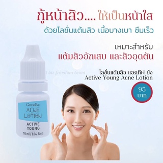 โลชั่น/ครีมแต้มสิว แอคทีฟ ยัง