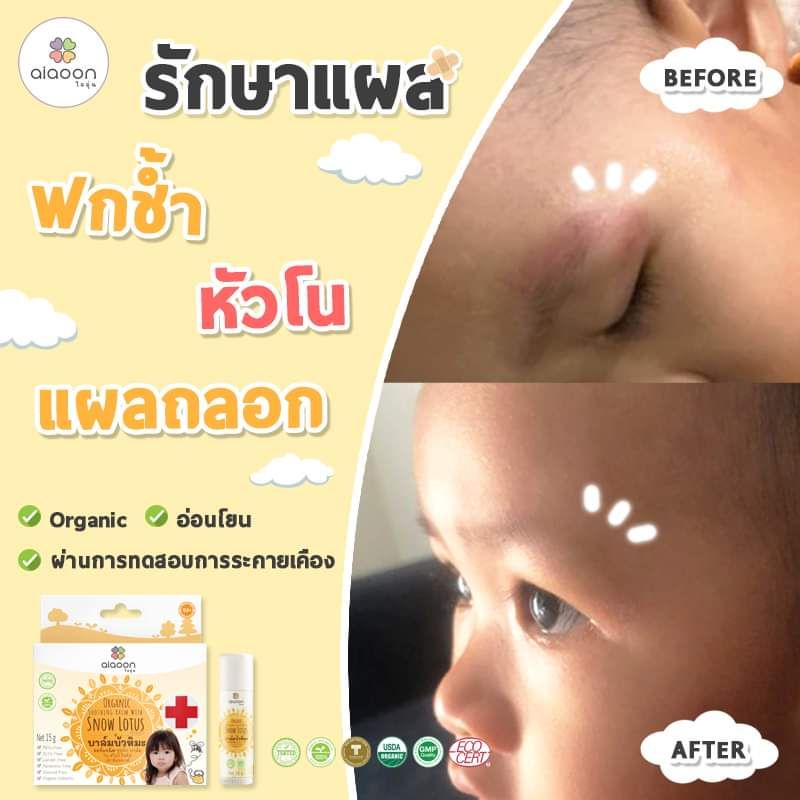 ไออุ่น บาล์มบัวหิมะออร์แกนิค Aiaoon Organic Soothing Balm With Snow Lotus -  Mommyandkiddy_Official - Thaipick